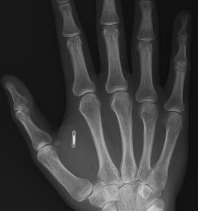 RFID_In_Hand